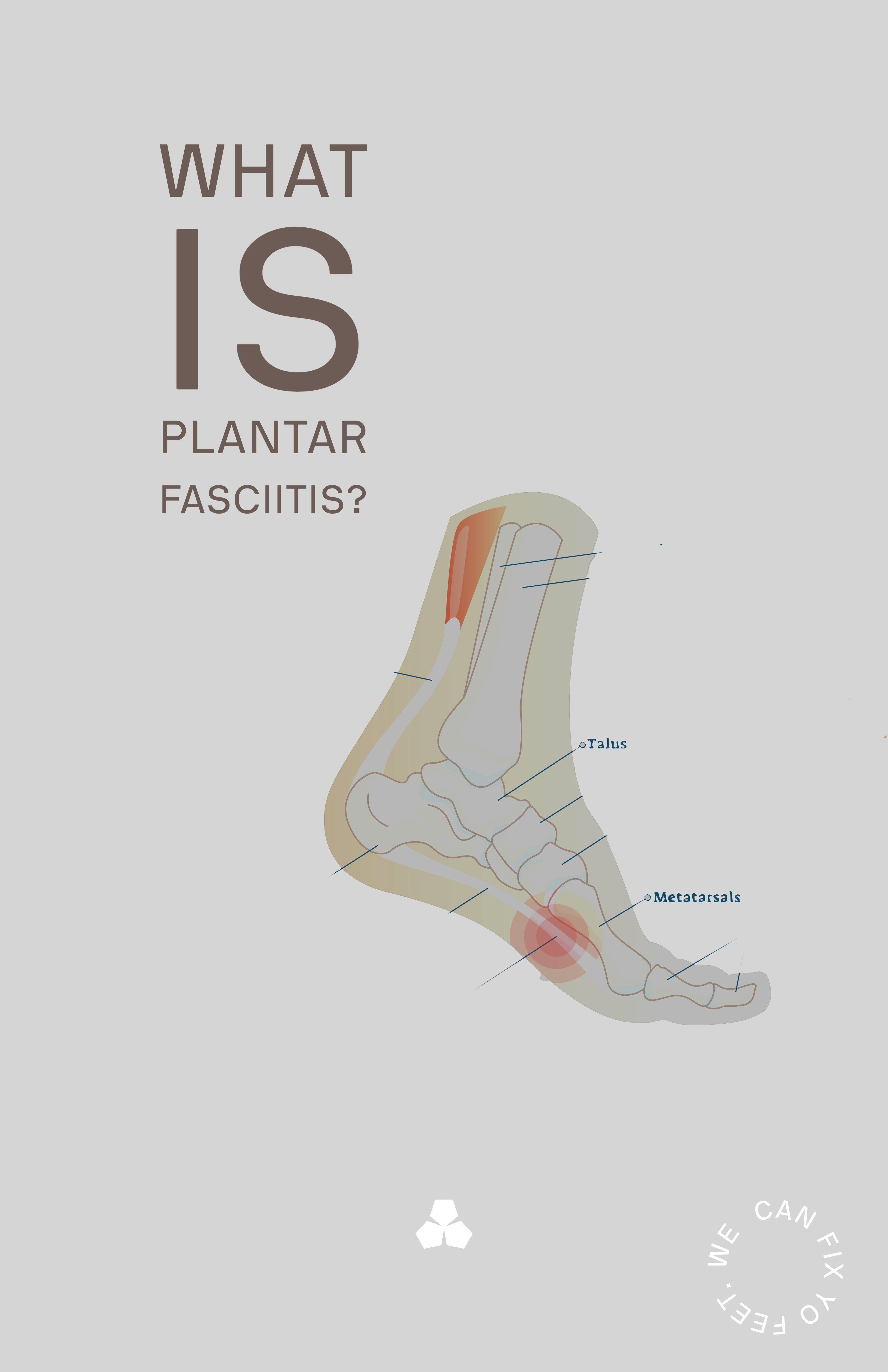 Do Your Feet Hurt In The Morning?