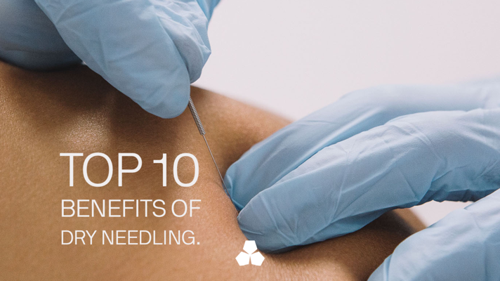 Top 10 Benefits of Dry Needling