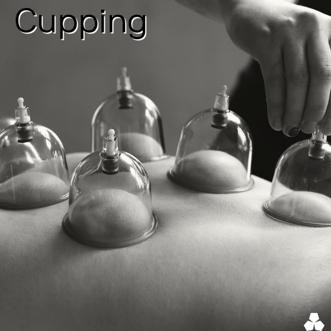 Learning About Cupping