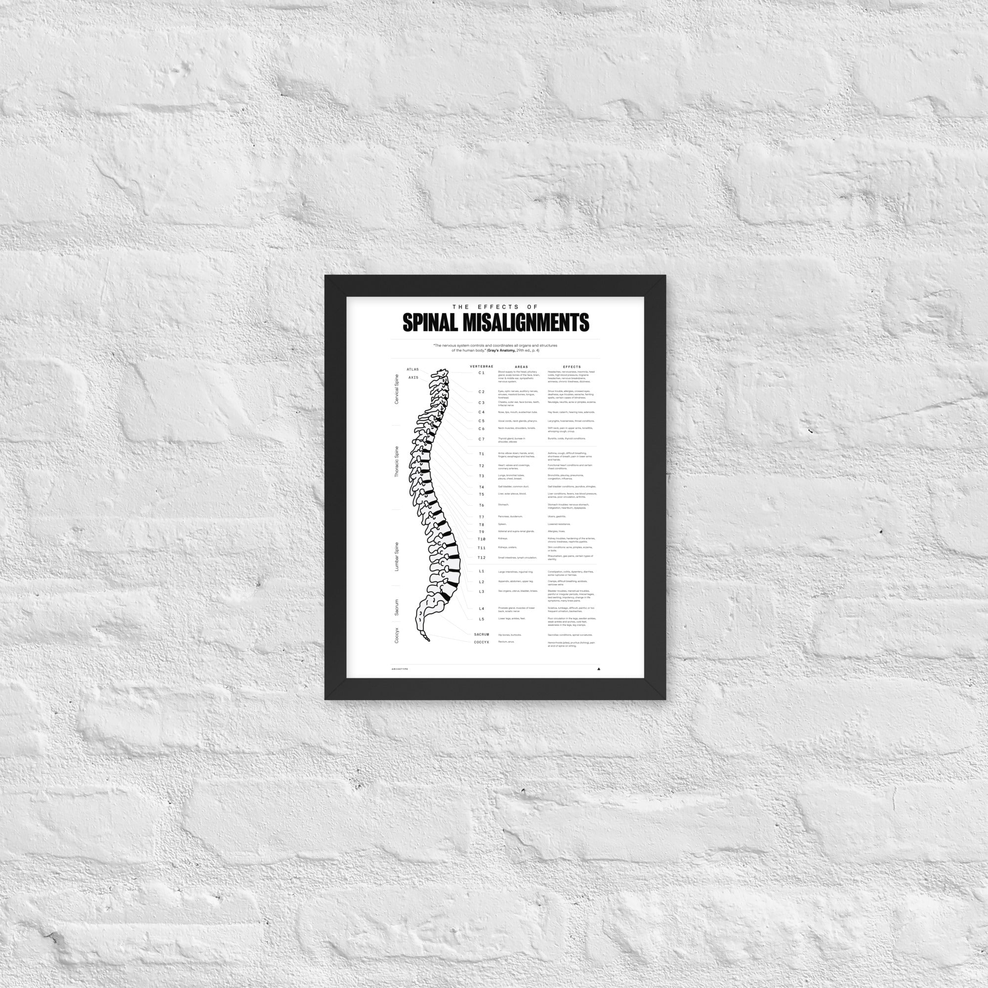 The Effects Of Spinal Misalignment