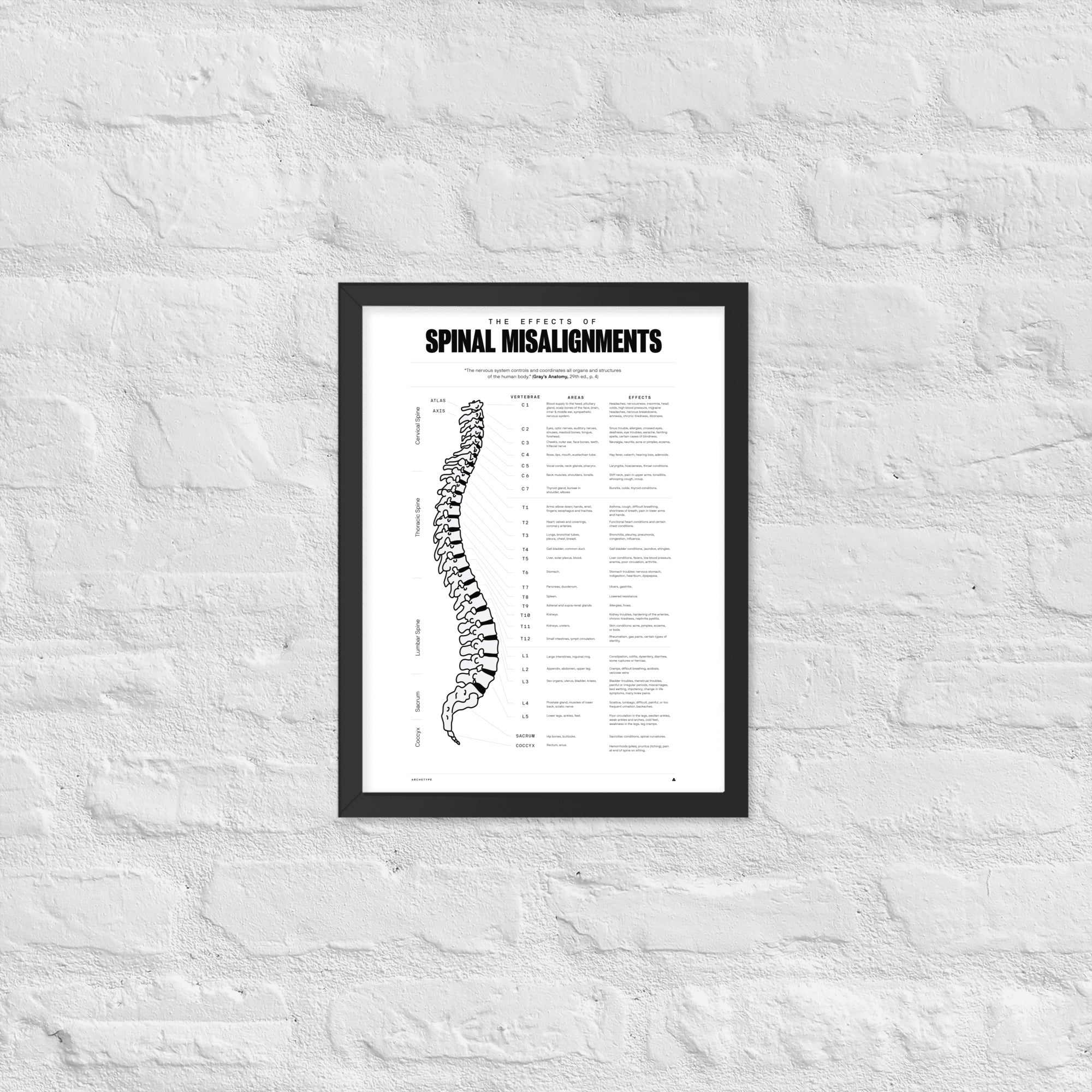 The Effects Of Spinal Misalignment