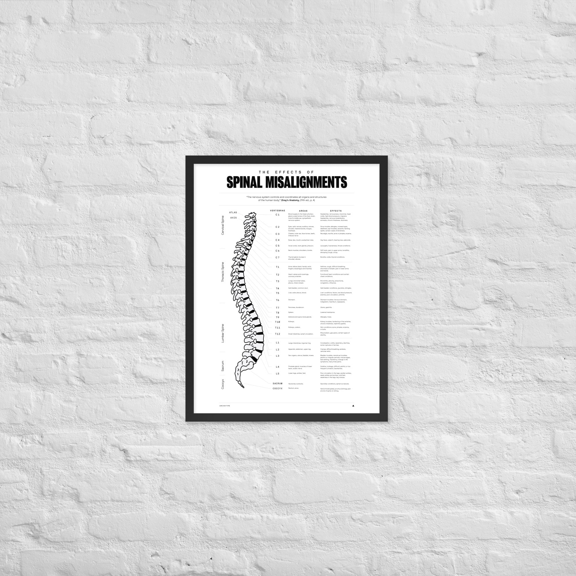 The Effects Of Spinal Misalignment