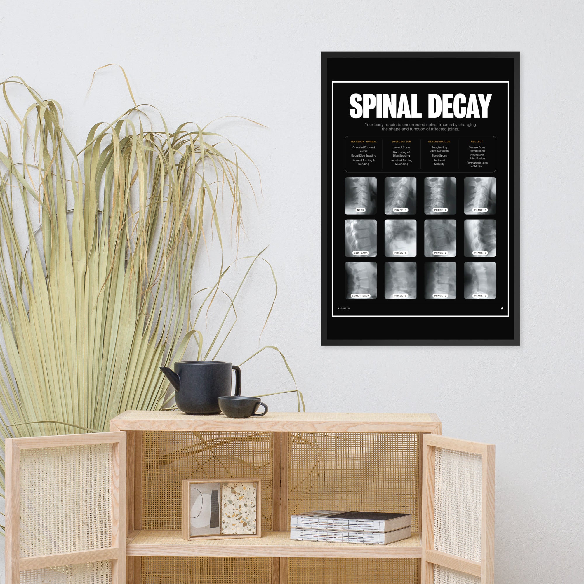 Spinal Decay