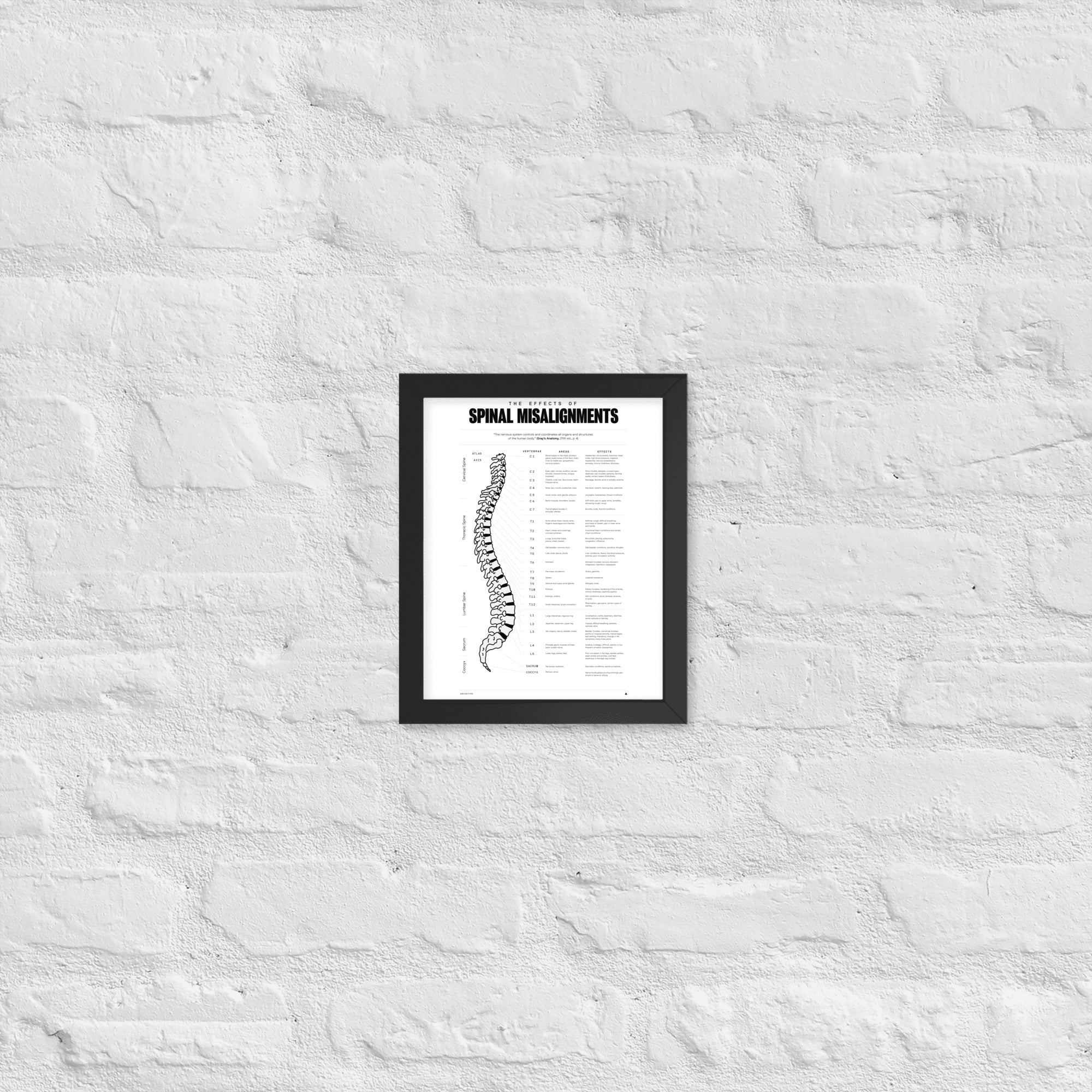 The Effects Of Spinal Misalignment